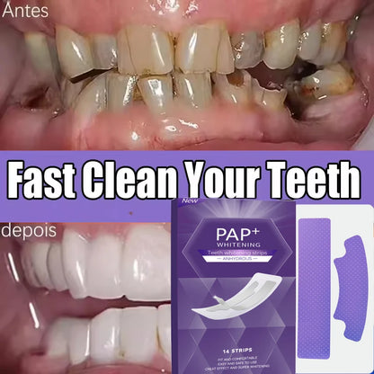 Purple Teeth Whitening Strips