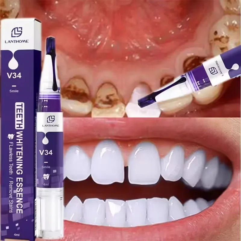 Purple Teeth Whitening Strips