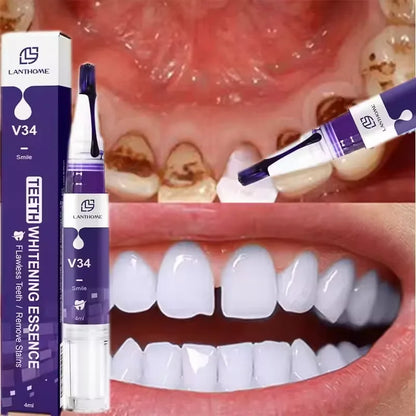 Purple Teeth Whitening Strips
